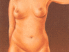 liposuccin