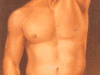 liposuccin