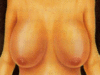 reduccion1